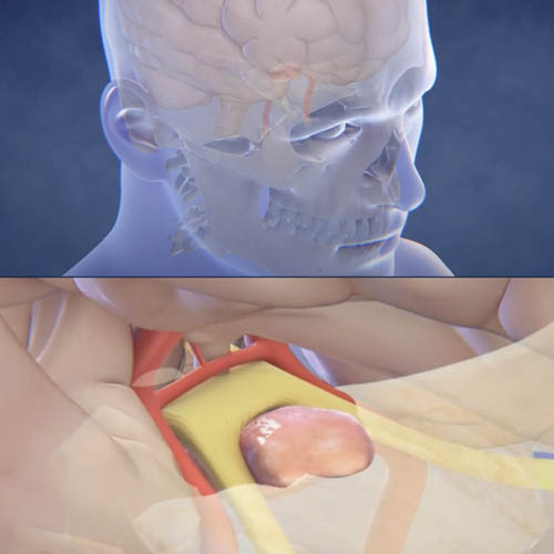 Endonasal surgical animation