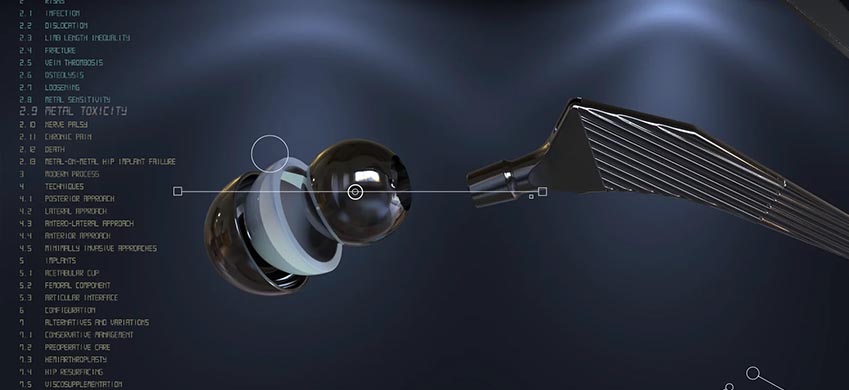 Medical Device Renderings